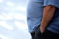 پیٹ کی چربی اور موٹاپا پاکستانی مردوں کو بانجھ پن کی طرف لے جارہا ہے: ماہرین